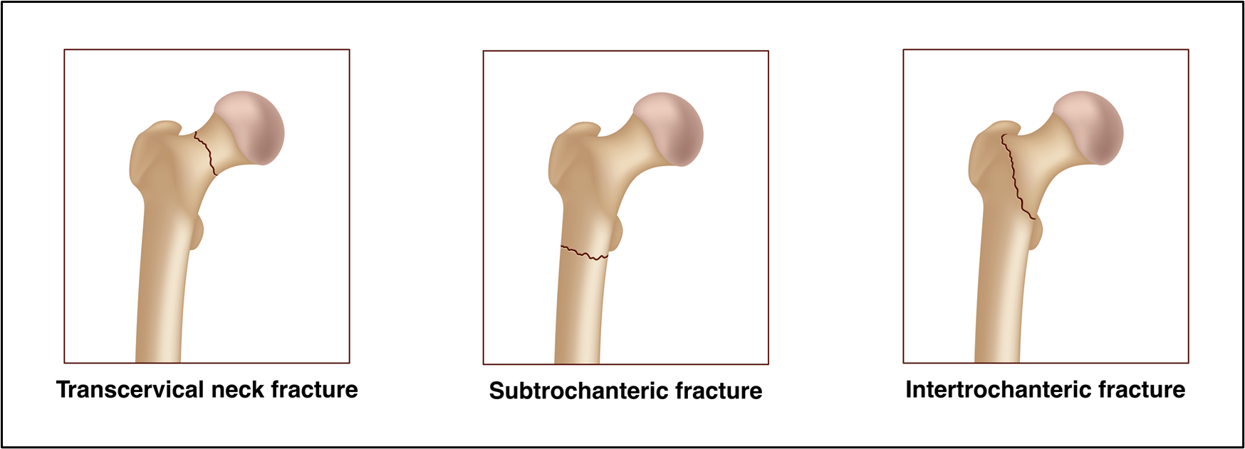 A diagram of bone joints
AI-generated content may be incorrect.